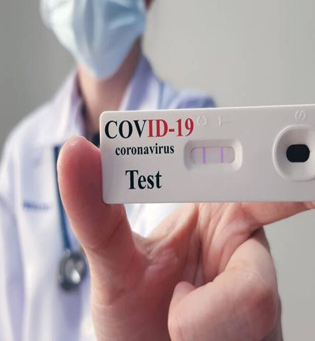 covid 19 test sierologico