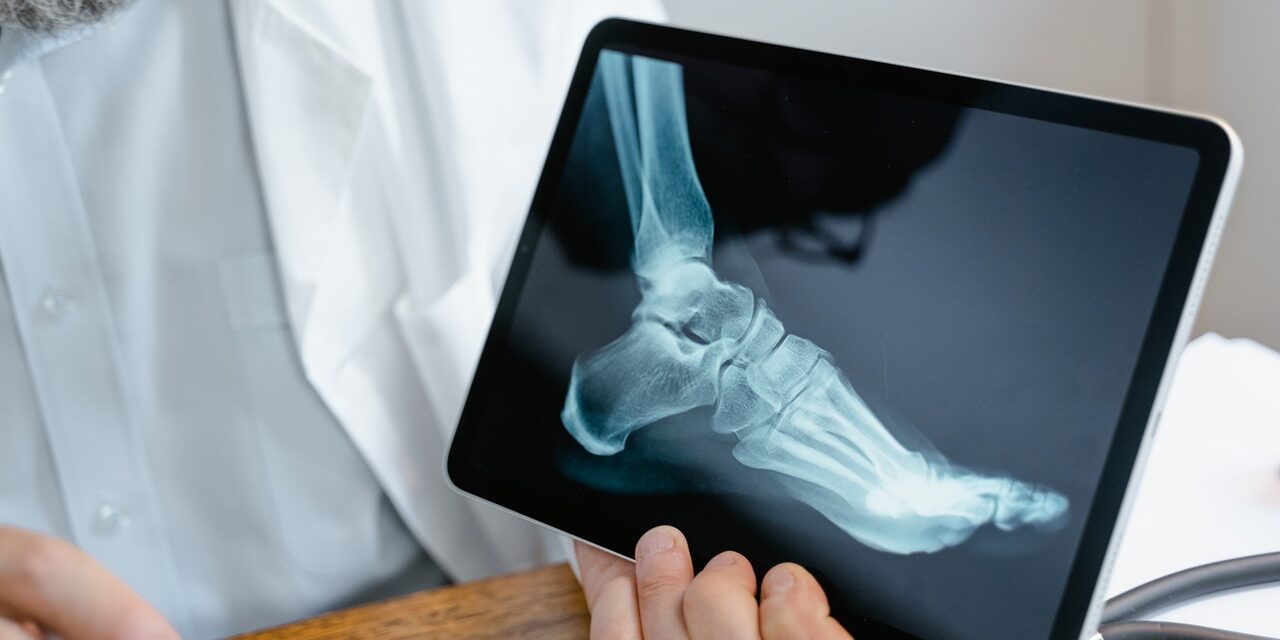 osteoporosi
