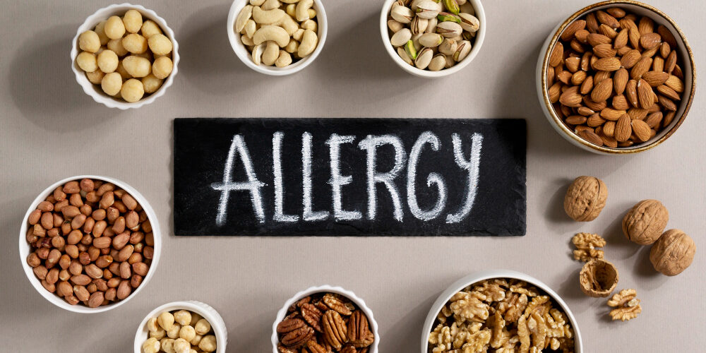 allergia alimentare